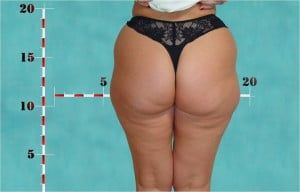 Before 2 BEAUTY by BUFORD Image