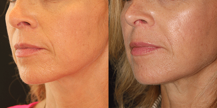 BEAUTY by BUFORD Image