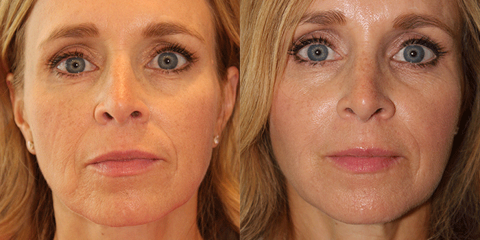 Blog image for Visualize the “V”