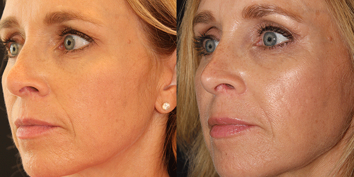 BEAUTY by BUFORD Image