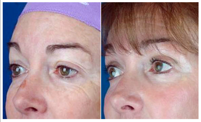 BEAUTY by BUFORD Image