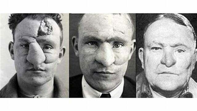 Blog image for The Roots of Modern Plastic Surgery