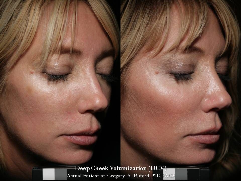 Blog image for Need to Look Great for that Big Event?  Here are 3 Easy Steps!