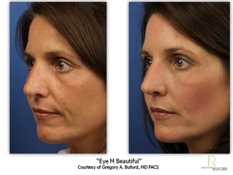 Blog image for As Seen on Fox 31’s Good Day Colorado with Peggy Bunker