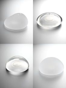 Blog image for Breast Augmentation Revision:  Why do I Need More Surgery?