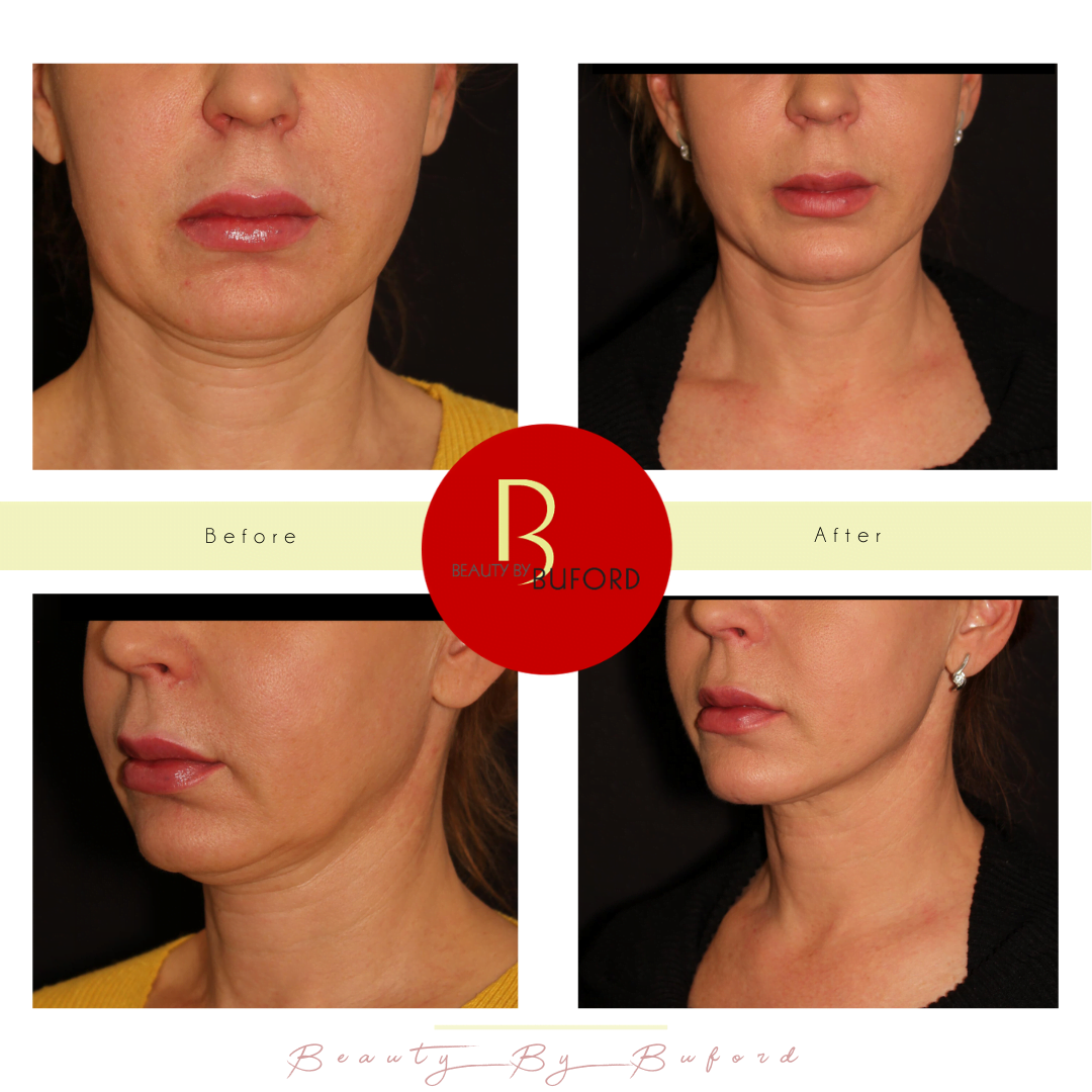 BEAUTY by BUFORD Image