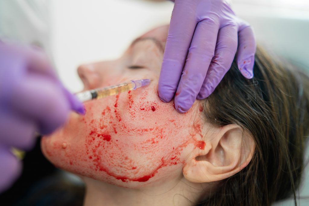 Blog image for Are Vampire Facials Dangerous? Gregory A. Buford, MD, FACS, PCEO Responds to HIV Scare at New Mexico Spa