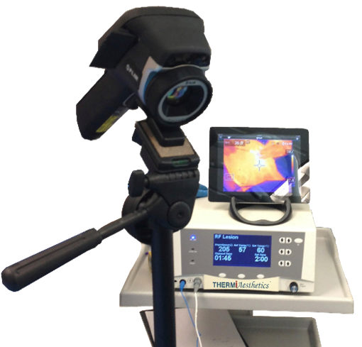 Blog image for Introducing the new ThermiFill procedure for Lip Rejuvenation