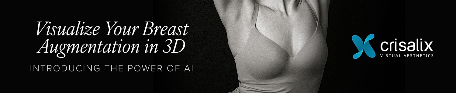 3D breast augmentation visualization with AI technology.