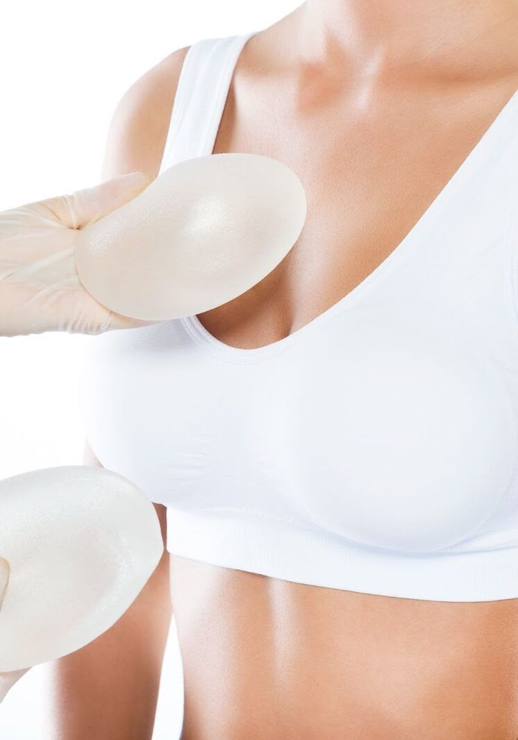 breast implant denver