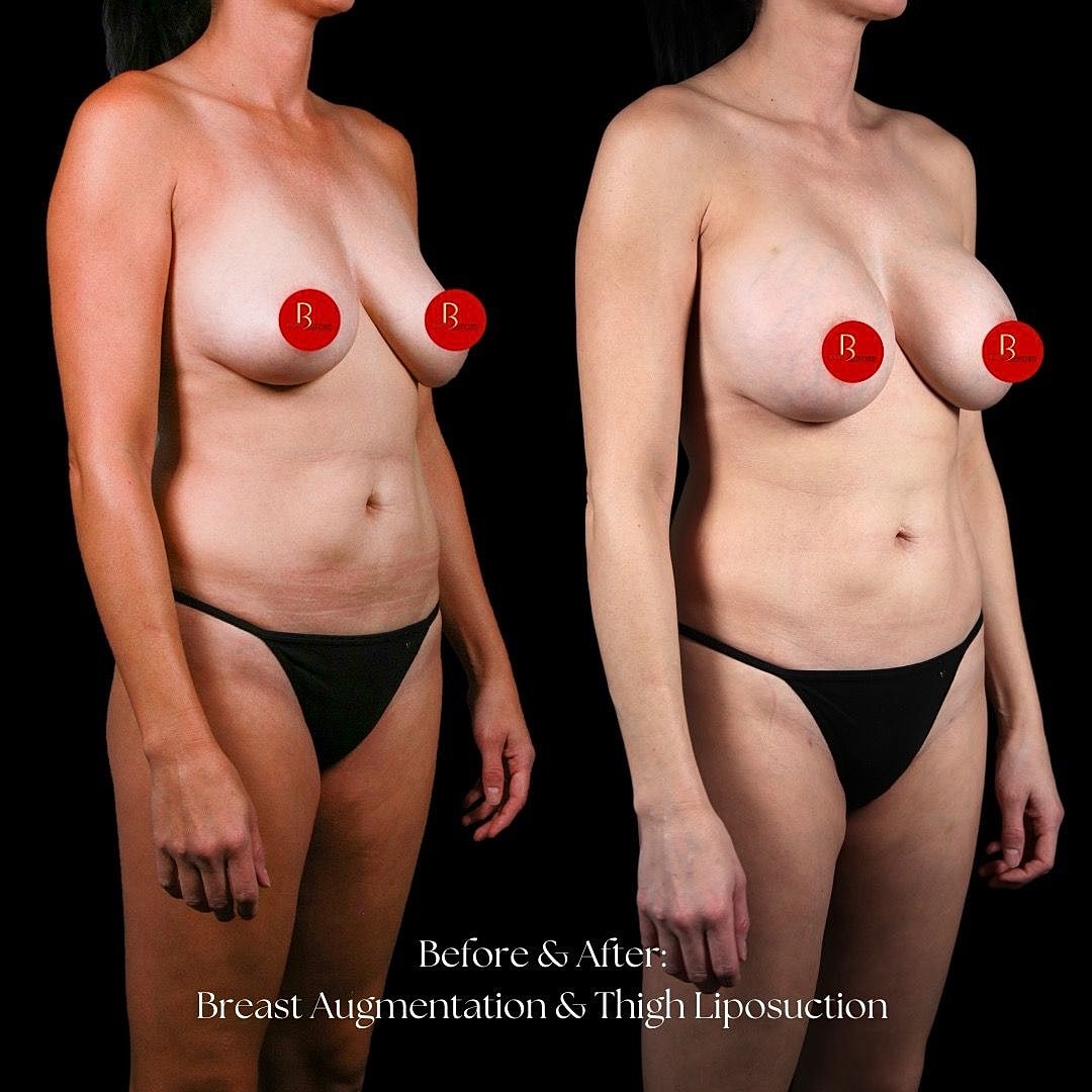 Before and after body transformation photo.